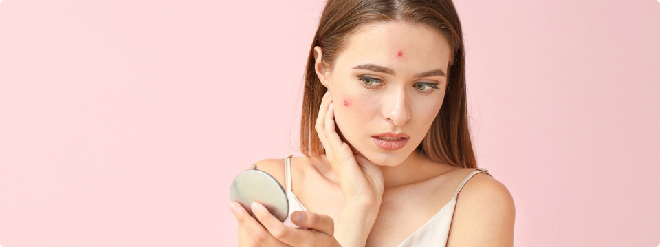 Средства для комплексного ухода за кожей с акне