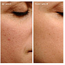 Endor Anti-aging Cream