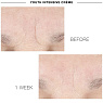 IS CLINICAL YOUTH INTENSIVE CREME